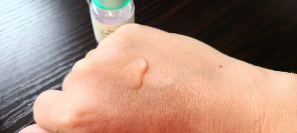 blemish treatment axis y