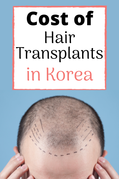 hair transplant cost south korea