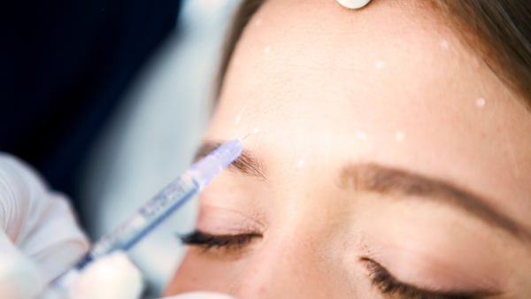acne treatment in korea