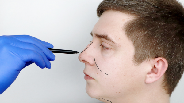 cost of nose surgery in korea