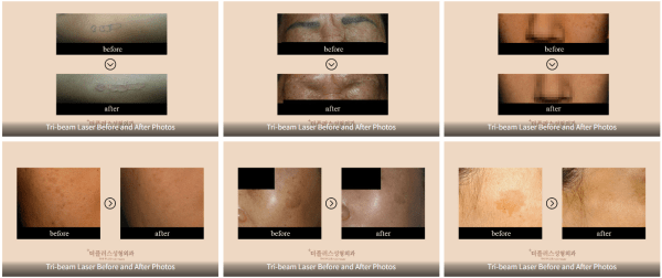 korean dermatologist