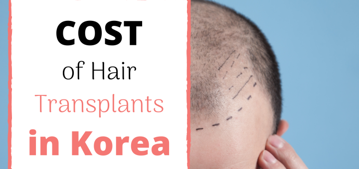 hair transplant cost korea