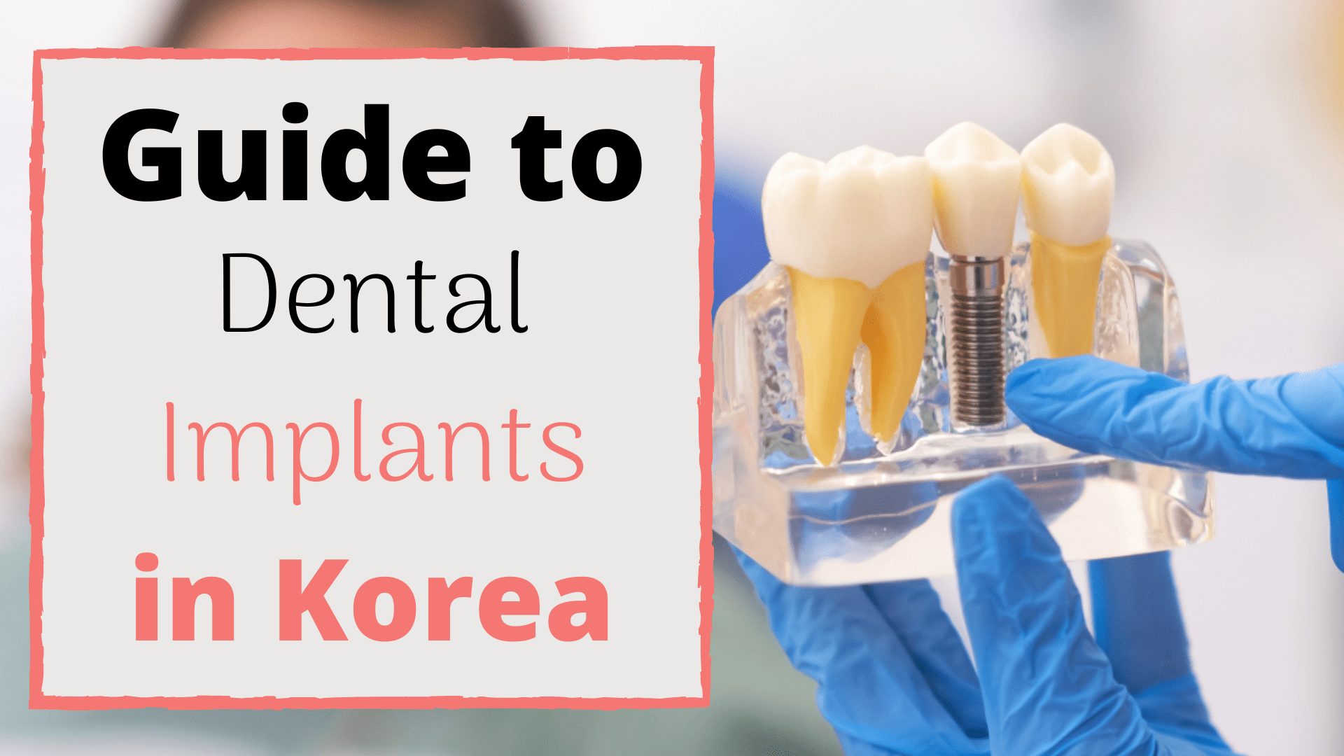 Dental Implants in Korea Cost, Best Clinics, What To Expect