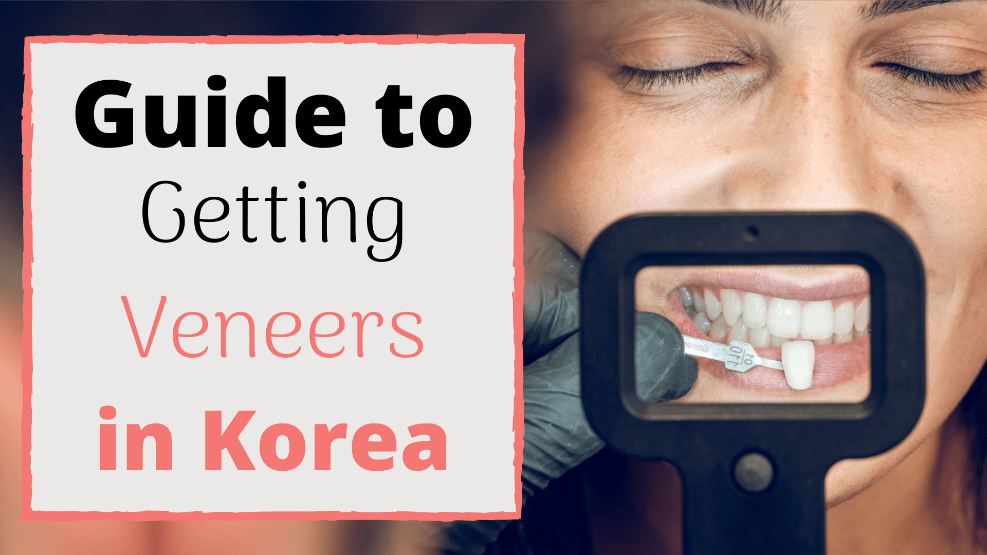 Veneers in Korea Best Dental Clinics, What To Expect & Prices